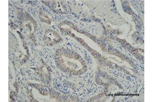 Immunohistochemistry (IHC) image for anti-Tumor Necrosis Factor Receptor Superfamily, Member 6b, Decoy (TNFRSF6B) antibody (ABIN2664922) (TNFRSF6B anticorps)
