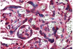 Human Placenta: Formalin-Fixed, Paraffin-Embedded (FFPE) (NDRG1 anticorps  (AA 1-395))