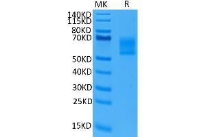 Human DKK3 on Tris-Bis PAGE under reduced conditions. (DKK3 Protein (AA 23-350) (His-Avi Tag))