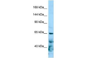 Western Blotting (WB) image for anti-RNA Polymerase II Subunit RPB1 (POLR2A) (N-Term) antibody (ABIN2788998) (POLR2A/RPB1 anticorps  (N-Term))