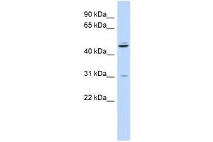 WB Suggested Anti-ZNF238 Antibody Titration:  0. (ZNF238 anticorps  (N-Term))