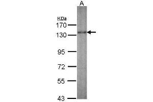 WB Image Sample (30 ug of whole cell lysate) A: IMR32 7.