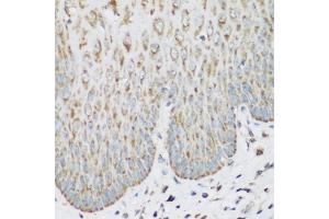 Immunohistochemistry of paraffin-embedded human esophagus using IGF2BP3 antibody (ABIN5972501) at dilution of 1/200 (40x lens). (IGF2BP3 anticorps)