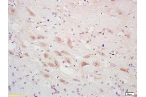 Formalin-fixed and paraffin embedded rat brain labeled with Rabbit Anti PSCA Polyclonal Antibody, Unconjugated (ABIN671676) at 1:200 followed by conjugation to the secondary antibody and DAB staining (PSCA anticorps  (AA 24-123))