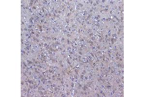 IHC analysis of GSTM3 using anti-GSTM3 antibody .