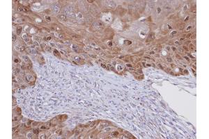 IHC-P Image Immunohistochemical analysis of paraffin-embedded SCC15 xenograft, using IDI1 , antibody at 1:100 dilution. (IDI1 anticorps)