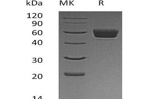Western Blotting (WB) image for Serine (Or Cysteine) Peptidase Inhibitor, Clade A, Member 3N (SERPINA3N) protein (His tag) (ABIN7320776)