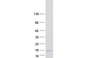 Validation with Western Blot