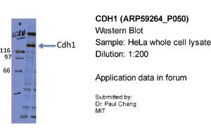 Sample Type: HeLa whole cell lysatePrimary Dilution: 1:200 (E-cadherin anticorps  (Middle Region))