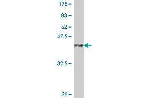 Western Blot detection against Immunogen (37.