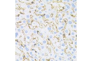 Immunohistochemistry of paraffin-embedded mouse liver using INSR antibody (ABIN5970115) at dilution of 1/100 (40x lens). (Insulin Receptor anticorps)