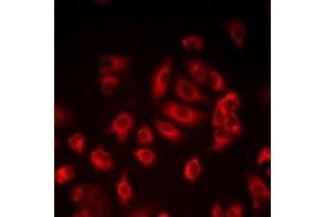 Immunofluorescent analysis of LITAF staining in HepG2 cells. (LITAF anticorps)