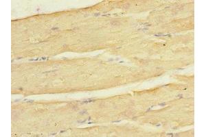 Immunohistochemistry of paraffin-embedded human skeletal muscle tissue using ABIN7157020 at dilution of 1:100 (KCNJ4 anticorps  (AA 316-445))