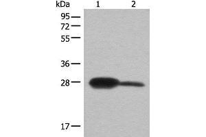 Western blot analysis of Mouse kidney tissue and A172 cell lysates using BDH2 Polyclonal Antibody at dilution of 1:600 (BDH2 anticorps)