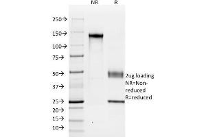 SDS-PAGE Analysis Purified KSP-Cadherin Mouse Monoclonal Antibody (SPM594). (Cadherin-16 anticorps)