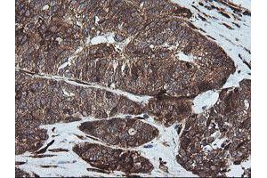 Immunohistochemistry (IHC) image for anti-Formiminotransferase Cyclodeaminase (FTCD) antibody (ABIN1496380)