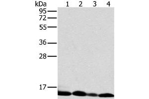 Western Blot analysis of Human liver tissue and K562 cell, Human fetal brain tissue and Raji cell using NDUFS5 Polyclonal Antibody at dilution of 1:400 (NDUFS5 anticorps)