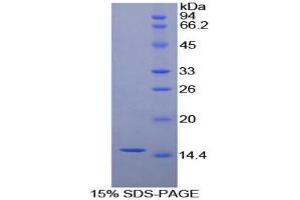SDS-PAGE (SDS) image for Carcinoembryonic Antigen Gene Family (CEA) (AA 566-698) protein (His tag) (ABIN1980680)