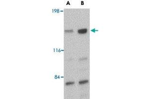 Western blot analysis of CADPS in rat brain tissue lysate with CADPS polyclonal antibody  at (A) 0. (CADPS anticorps  (C-Term))
