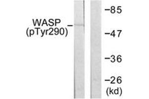 Western blot analysis of extracts from HepG2 cells, using WASP (Phospho-Tyr290) Antibody. (WASP anticorps  (pTyr290))