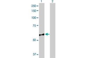 Western Blot analysis of NUP98 expression in transfected 293T cell line by NUP98 MaxPab polyclonal antibody. (NUP98 anticorps  (AA 1-606))