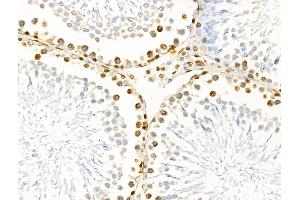 ABIN6261411 and ABIN6266531 at 1/100 staining Rat testis tissue by IHC-P.