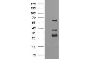 Image no. 1 for anti-Tripartite Motif Containing 45 (TRIM45) (AA 288-580) antibody (ABIN1491334) (TRIM45 anticorps  (AA 288-580))