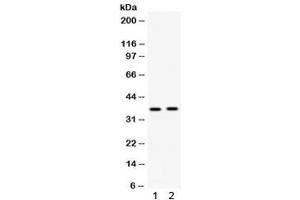 Western blot testing of 1) rat kidney and 2) human HepG2 lysate with Fos B antibody. (FOSB anticorps)
