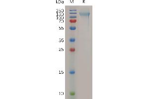 Human NCL Protein, His Tag on SDS-PAGE under reducing condition.