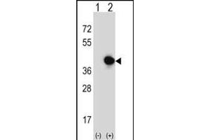 Western blot analysis of RFC5 (arrow) using rabbit polyclonal RFC5 Antibody (Center ) (ABIN389314 and ABIN2839435).