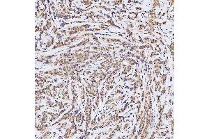 IHC analysis of SSRP1 using anti-SSRP1 antibody (ABIN7600496).