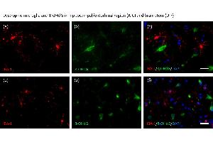 Aged human brain tissue samples of individuals with morphologically dystrophic (a–f) and microglia were stained with an anti-IBA-1 antibody (red: a, d), anti-8-OHdG antibody (green: b, e), and DAPI (blue). (8-OHDG anticorps)