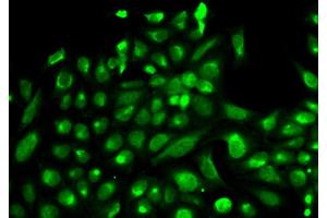 Immunofluorescence analysis of HeLa cell using SPHK1 antibody. (SPHK1 anticorps  (AA 50-384))