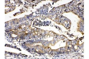 anti-Calpain 2 (CAPN2) (AA 500-700) antibody