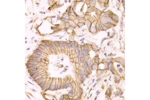 Immunohistochemistry (IHC) image for anti-Catenin (Cadherin-Associated Protein), delta 1 (CTNND1) (AA 573-832) antibody (ABIN3022309) (CTNND1 anticorps  (AA 573-832))