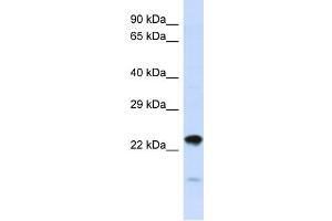 Host:  Rabbit  Target Name:  NIPSNAP3A  Sample Type:  HepG2 Whole Cell lysates  Antibody Dilution:  1. (NIPSNAP3A anticorps  (N-Term))