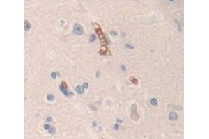 Used in DAB staining on fromalin fixed paraffin- embedded Kidney tissue (Contactin 6 anticorps  (AA 658-907))