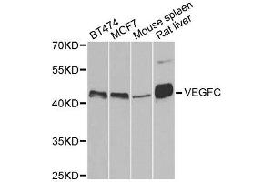 Western blot analysis of extracts of various cell lines, using VEGFC antibody. (VEGFC anticorps)