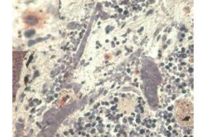 Immunohistochemistry staining with anti-human HLA-G (MEM-G/1).