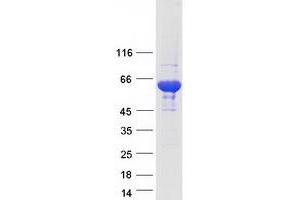 Validation with Western Blot