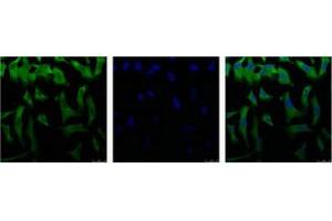 Immunofluorescence staining of HeLa cell line with antibody (Left), DAPI (Middle) and merge (Right). (EIF4A1 anticorps  (C-Term))