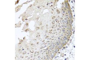 Immunohistochemistry of paraffin-embedded human esophagus using IRS2 antibody (ABIN5974770) at dilution of 1/100 (40x lens). (IRS2 anticorps)