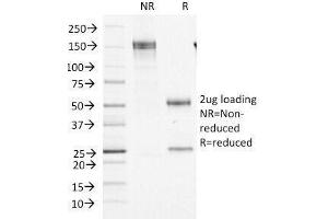 SDS-PAGE Analysis of Purified, BSA-Free Factor XIIIa Antibody (clone F13A1/1448). (F13A1 anticorps  (AA 46-181))