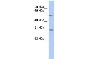 WB Suggested Anti-RELB Antibody Titration:  0. (RELB anticorps  (Middle Region))