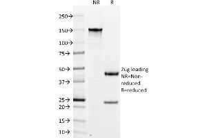 SDS-PAGE Analysis Purified PLGF Monoclonal Antibody (PLGF/94). (PLGF anticorps)