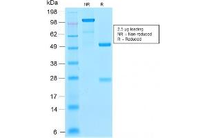 SDS-PAGE Analysis Purified p21 Rabbit Recombinant Monoclonal Antibody (CIP1/2275R). (Recombinant p21 anticorps)