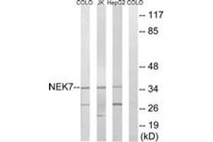 Western blot analysis of extracts from HepG2/Jurkat/COLO cells, using NEK7 Antibody. (NEK7 anticorps  (AA 101-150))