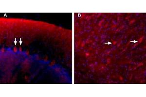 Binding of Stichodactyla Toxin-ATTO Fluor-590 to Purkinje cells in the rat cerebellum. (Stichodactyla Toxin peptide (Atto 590))