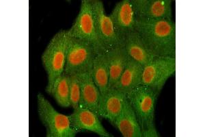 IF analysis of FEN1 using anti-FEN1 antibody (ABIN7601617) and anti-Beta Tubulin antibody (ABIN7602743). (FEN1 anticorps  (AA 4-300))