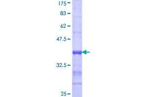 Image no. 1 for Acyl-CoA Synthetase Long-Chain Family Member 1 (Acsl1) (AA 48-145) protein (GST tag) (ABIN1305710)
